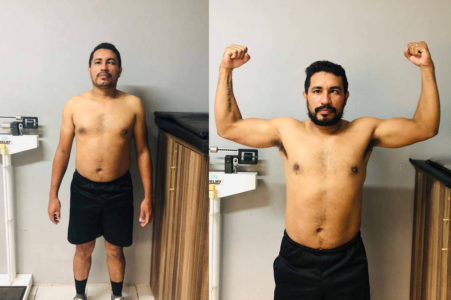 Transformação de Roberto Almeida